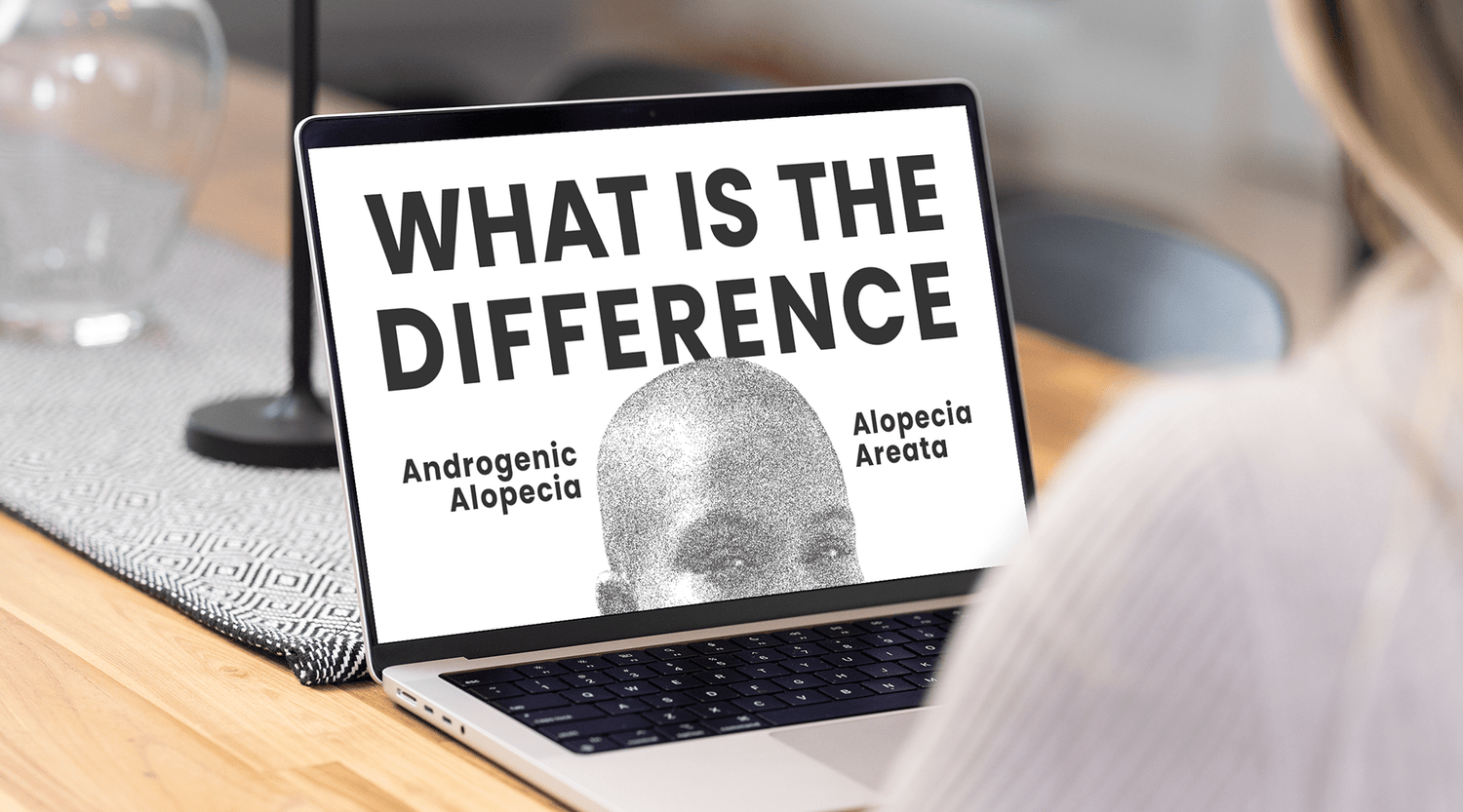 Understanding Hair Loss: Androgenetic Alopecia vs. Alopecia Areata