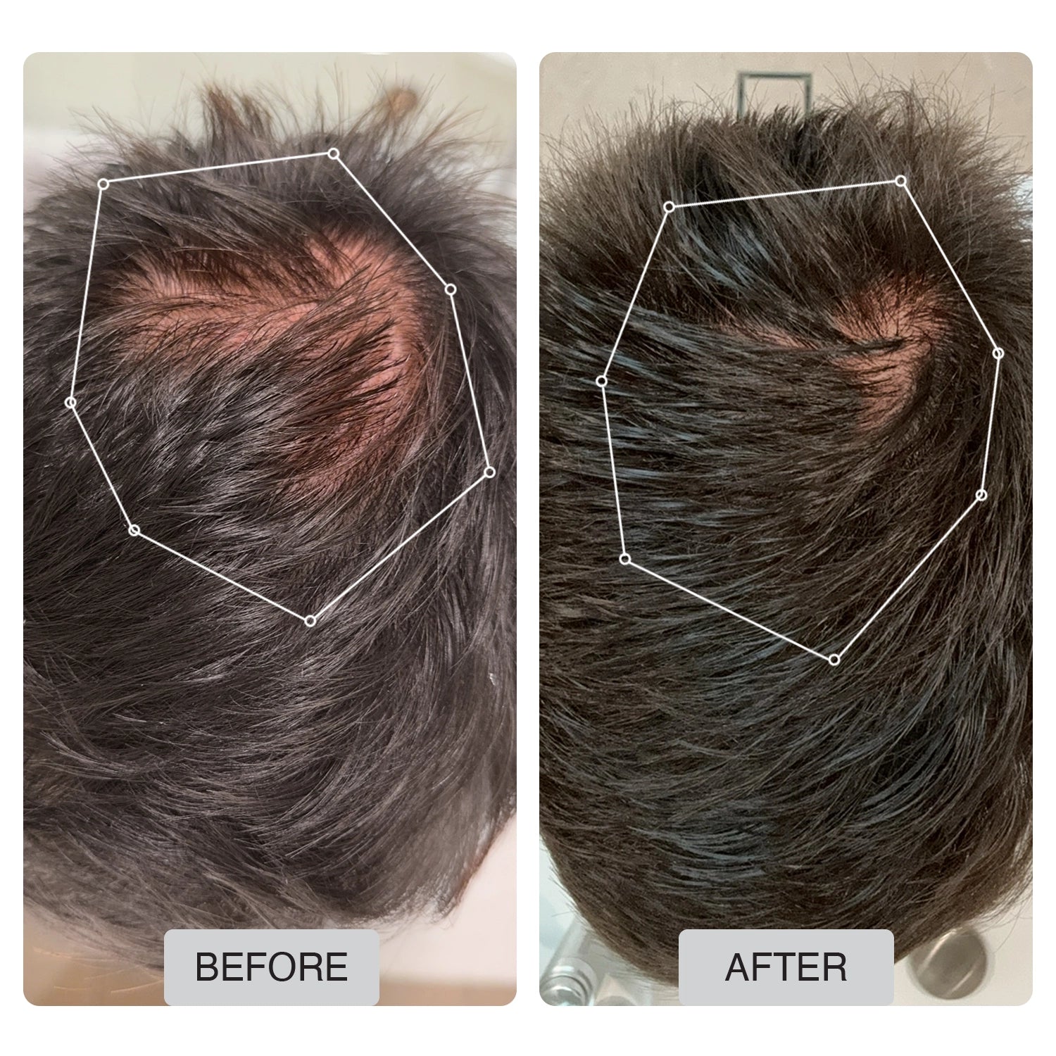 Total Hair Regrowth System